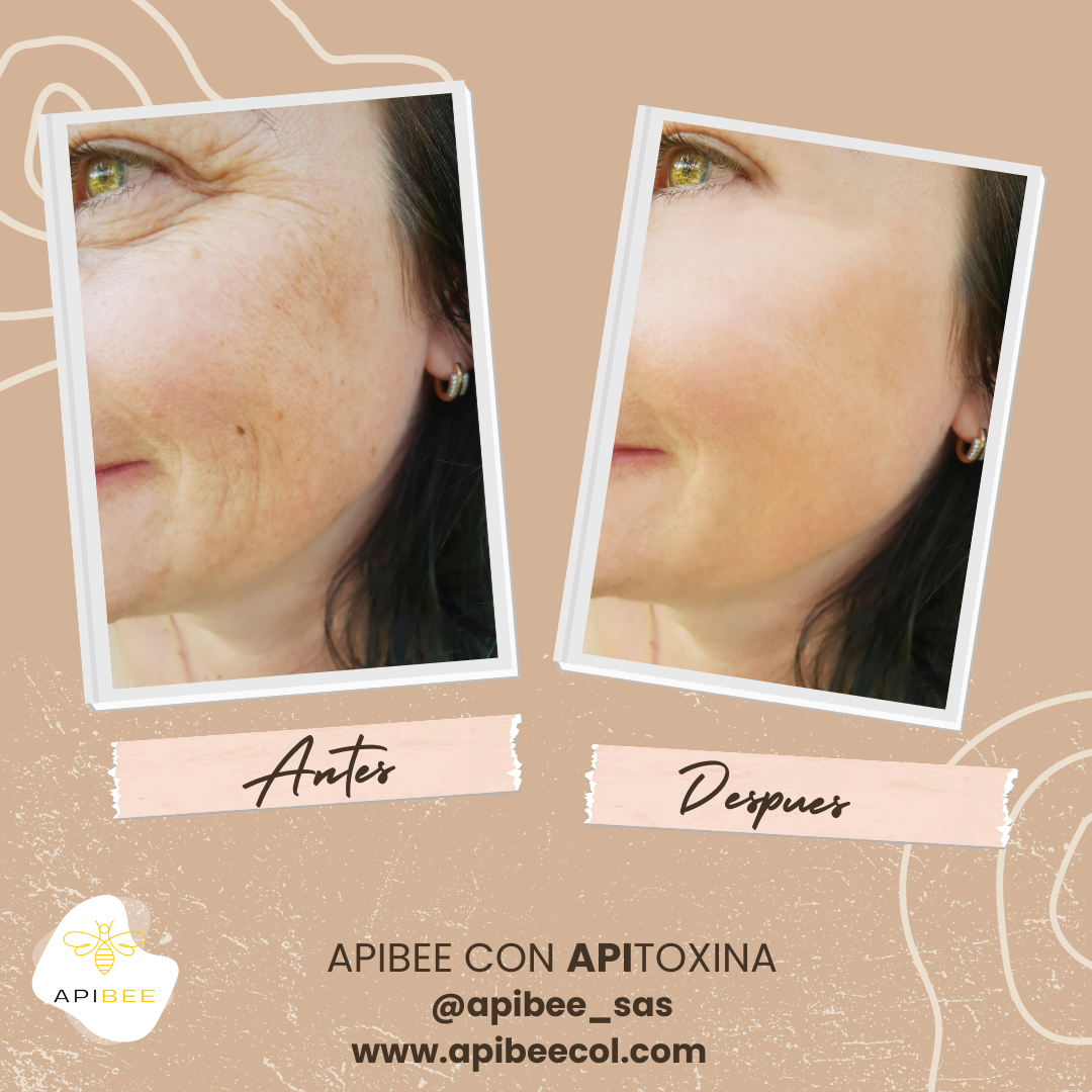 Crema con Apitoxina